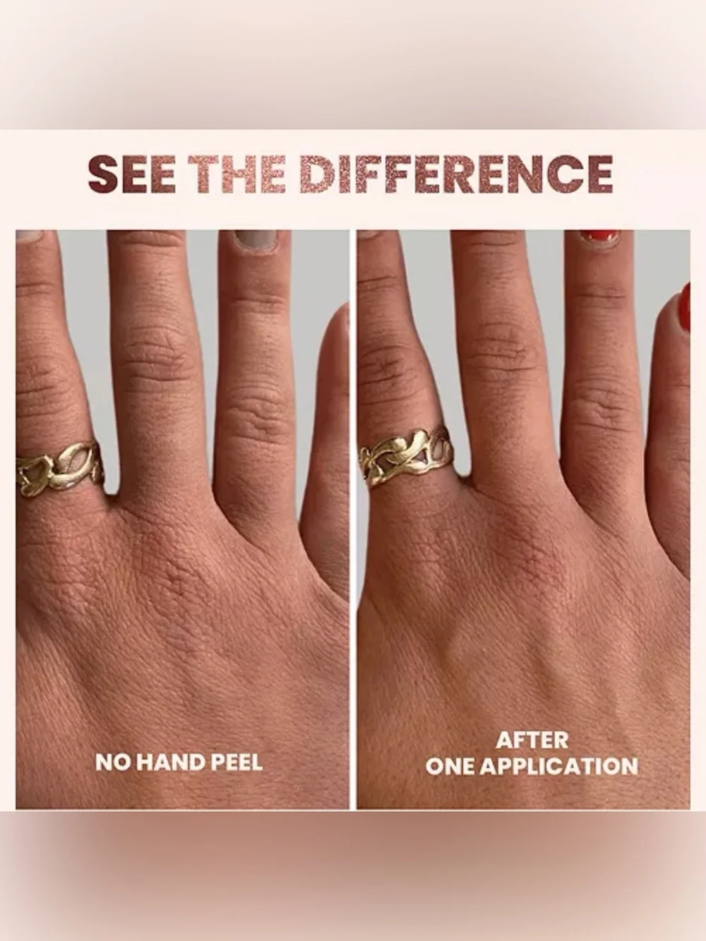 Londontown Rose Gold Hand Peel 104 ml/3.5 fl oz